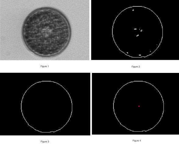 Four figures showing plankton image processing from raw image to outline with centroid